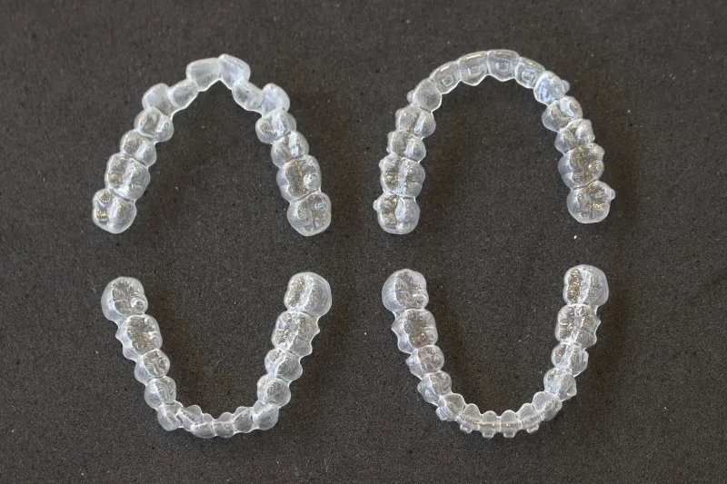 マウスピース矯正の期間や費用を奈良県大和郡山市で比較検討して始めるための完全ガイド